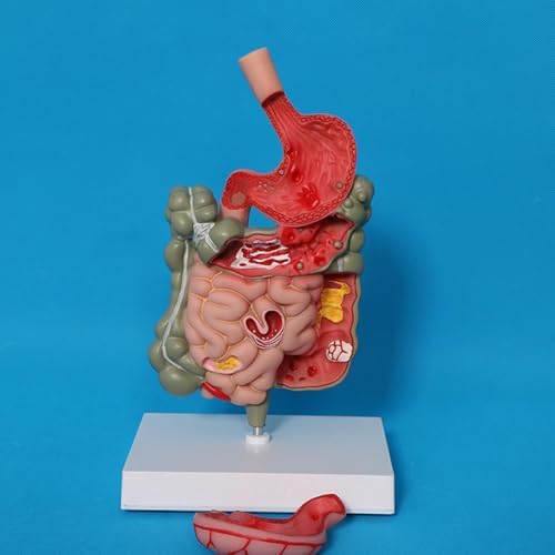 Human Digestive System Model Medical Professional Sturdy PVC Educational Stomach Model Demonstration Science Study - Image 7