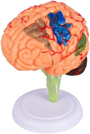 Brain Model, 32-Part Detachable Anatomy Kit by Simedutech